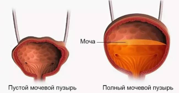 Почему диабетики много мочатся
