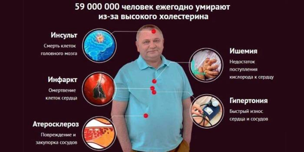 10 способов улучшить память после 50 лет 10 способов улучшить память после 50 лет