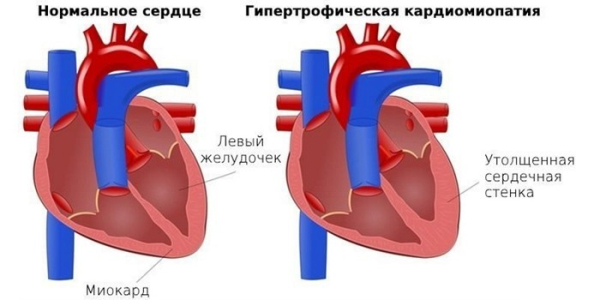 Изменения в сердце после 50 о которых важно знать Изменения в сердце после 50 о которых важно знать