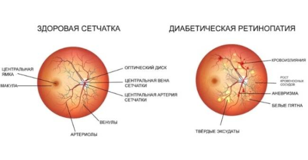 11 причин нечеткости зрения