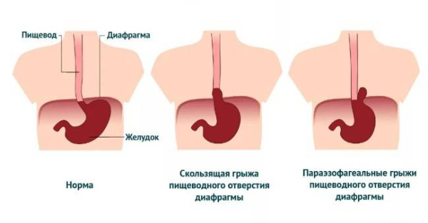 Почему кислотность увеличивается с возрастом Почему кислотность увеличивается с возрастом